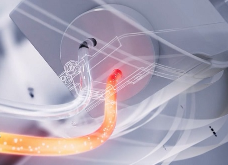 X线球管热容量是越大越好吗?