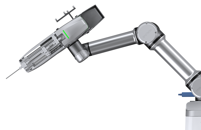 骨科手术机器人多少钱一台